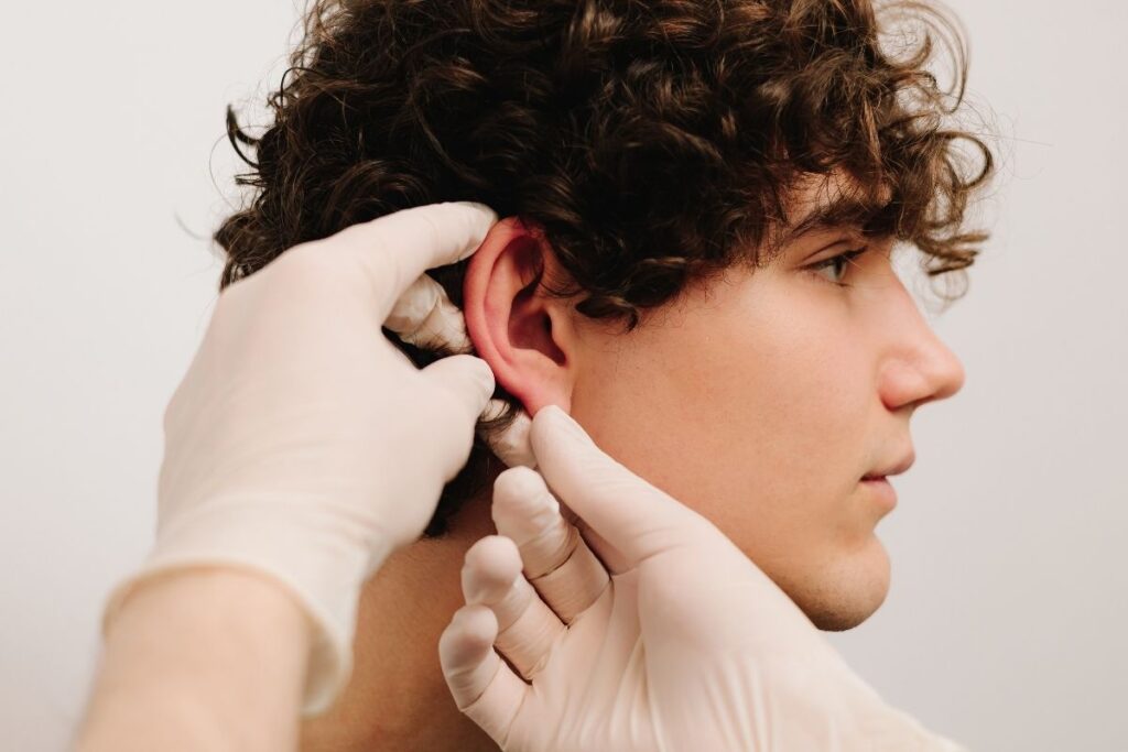 Otoplasty Surgery