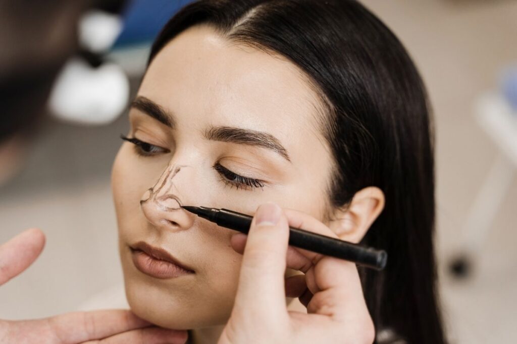 Op. Dr. Kadri Akıncı Revision Rhinoplasty