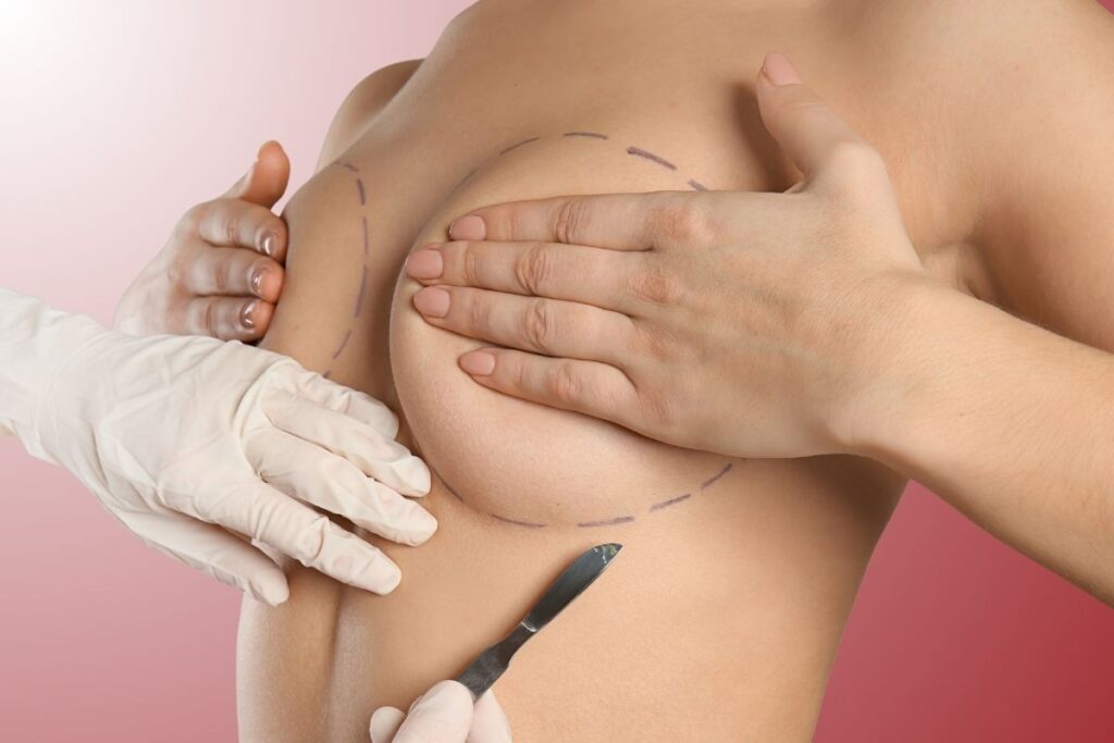 Breast Lift Surgery in Istanbul - Dr. Kadri Akıncı