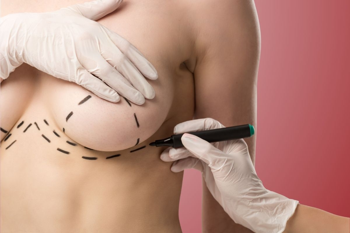 Breast Lift Surgery in Istanbul
