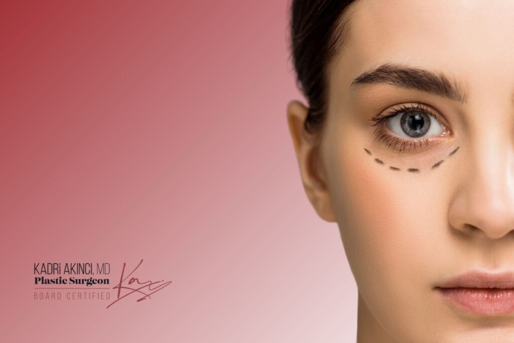 Fox Eye Surgery in istanbul – Cost, Results & Procedure Fox Eye Surgery Before and After Results